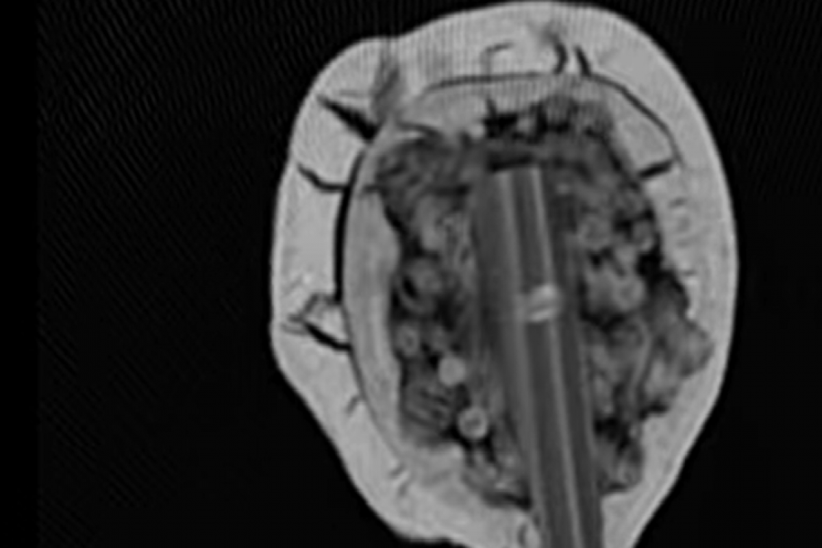 A CT scan which shows the different layers of the merman's head